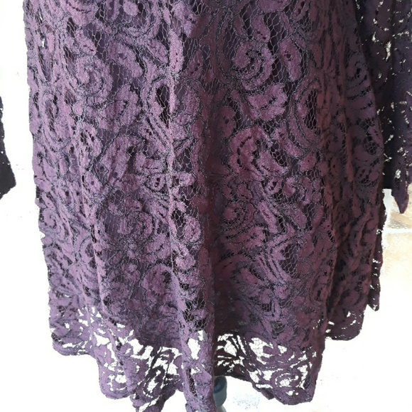 Urban Outfitters KIMICHI BLUE baby doll lace dress - Picture 3 of 7